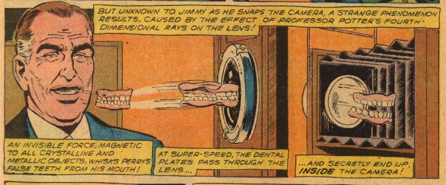 4-dimensional tooth displacement
